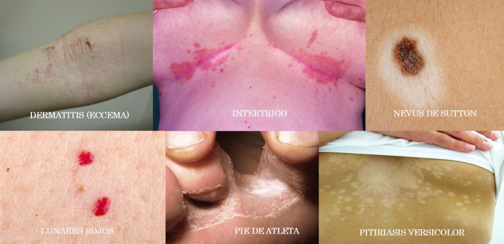 Imagen Artículo Lesiones en la piel frecuentes